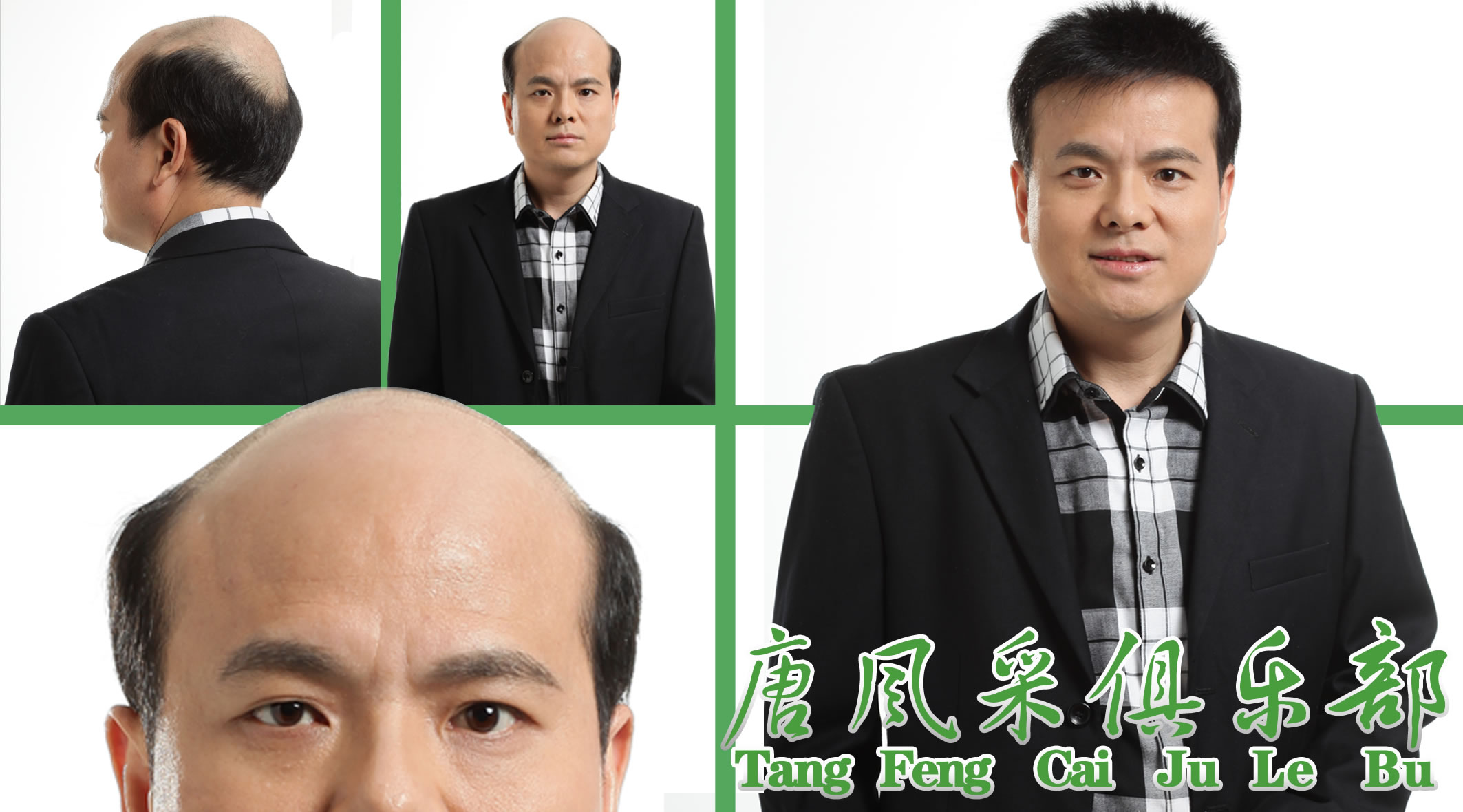 假發(fā)、跟織發(fā)有什么區(qū)別
