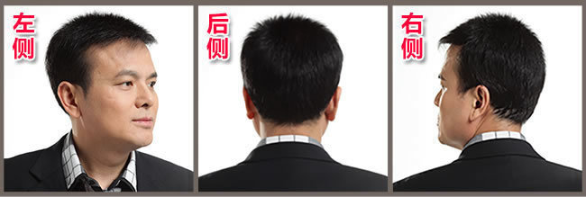 前額兩邊頭發(fā)稀疏怎么辦？看了你就知道怎么解決！