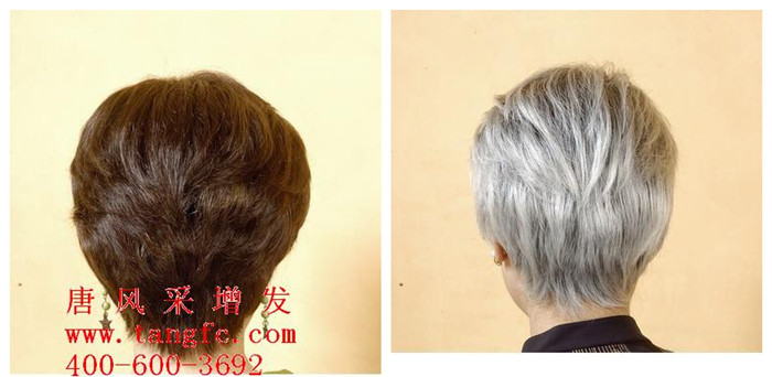 怎樣才能讓白發(fā)變黑？分享白發(fā)變黑方案！