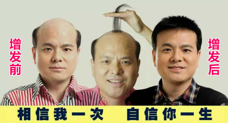 補(bǔ)頭發(fā) 補(bǔ)頭發(fā)的食物有哪些 電子時(shí)代如何防脫發(fā)