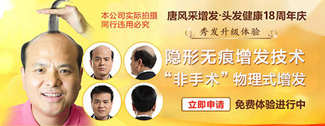 哪里能進(jìn)行男士頭發(fā)加密？找回獨(dú)特魅力全靠它！