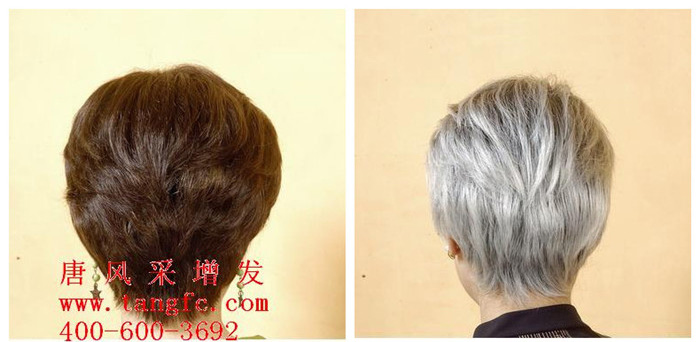 白發(fā)變黑的小竅門有哪些？青年白發(fā)怎么辦？