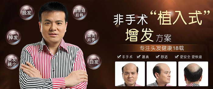 唐風采補發(fā)怎么樣？無手術(shù)無藥物百分百根治秀發(fā)問題！