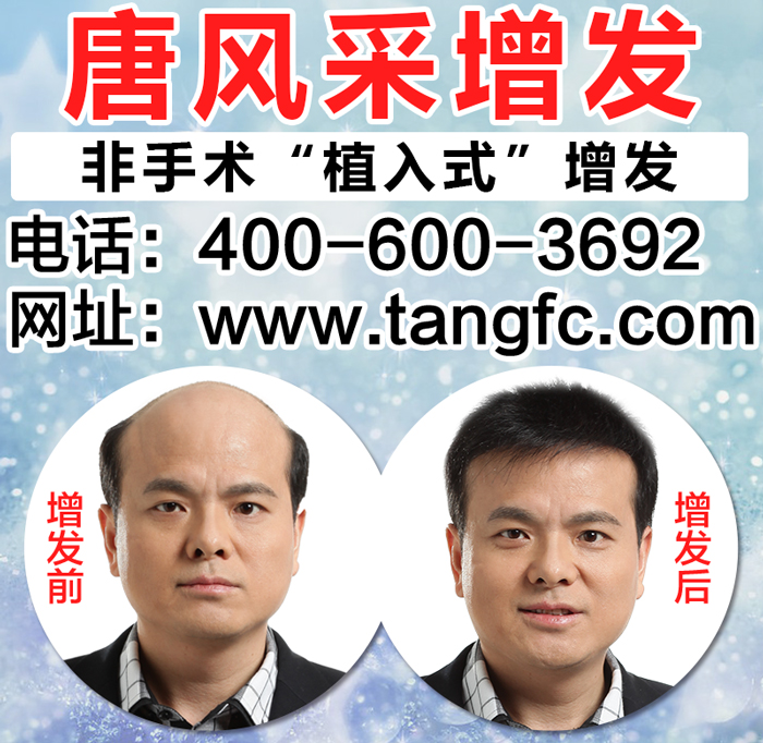 沈陽(yáng)哪里有織發(fā)？有需求的往哪里找呢？