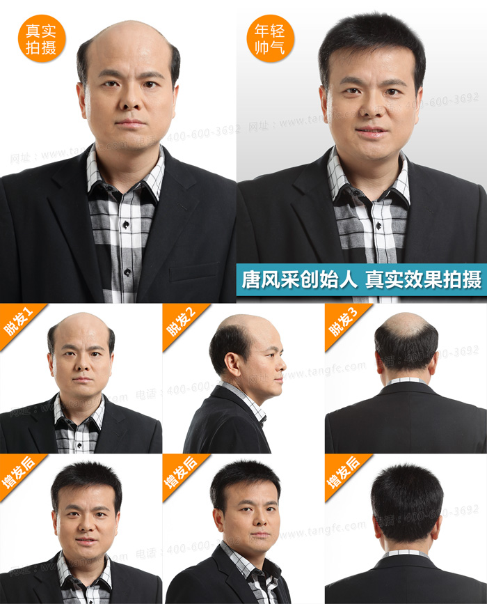 真發(fā)假發(fā)是什么，真發(fā)假發(fā)專賣哪個(gè)牌子好？