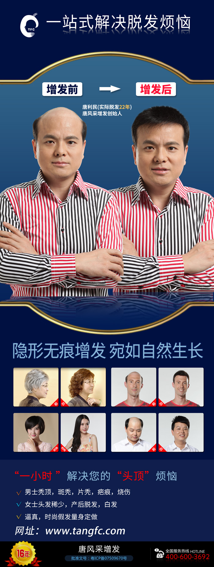無(wú)痕補(bǔ)發(fā)價(jià)格是多少？哪里補(bǔ)發(fā)技術(shù)比較好？
