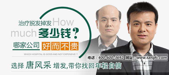 織發(fā)哪個(gè)牌子好 織發(fā)哪個(gè)牌子好 禿頂可以進(jìn)行織發(fā)嗎