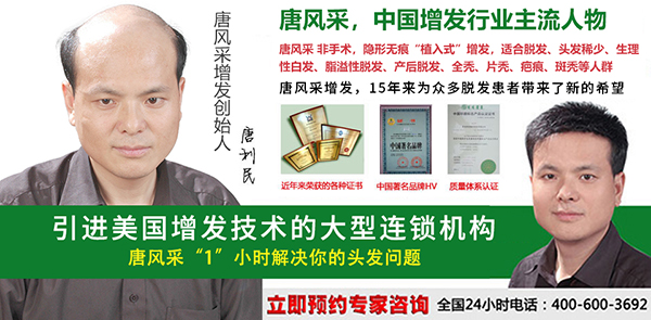 早禿怎么辦？哪里能進行男士頭發(fā)加密？