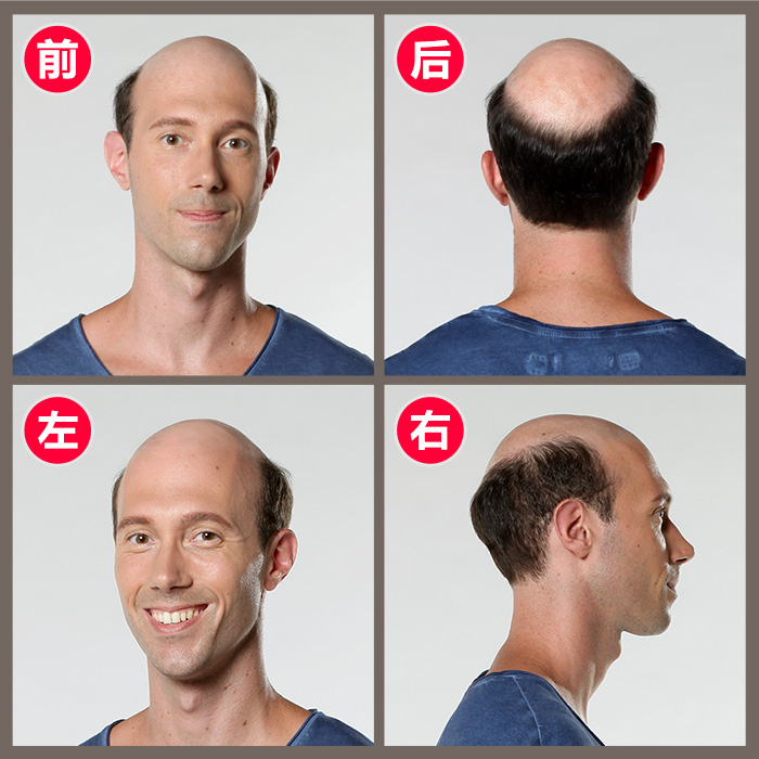 頭發(fā)再生 頭發(fā)可不可以再生 航天技術(shù)細(xì)微的成就感
