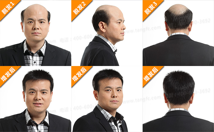 大同那里有男人假發(fā)買？時(shí)尚達(dá)人之男士假發(fā)