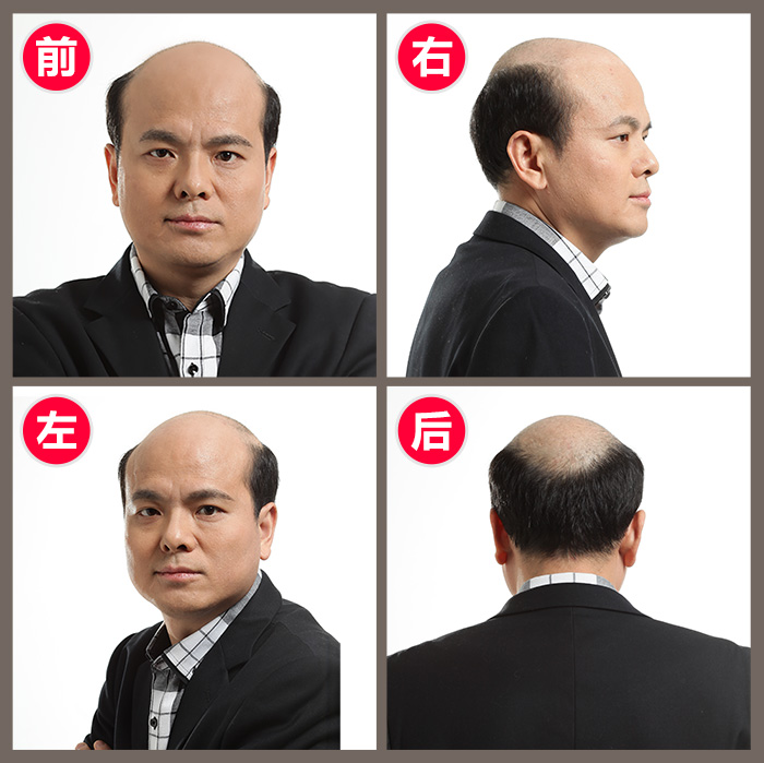 男生假發(fā)一般多少錢？教你最短時(shí)間選擇男生假發(fā)
