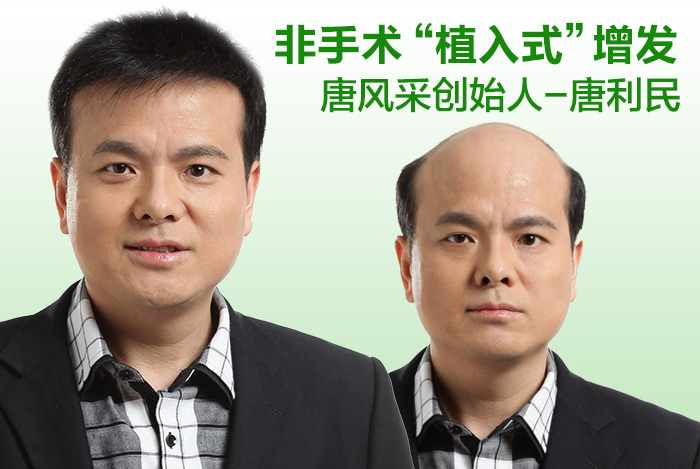 唐風采補發(fā)合肥店怎么樣？隱形無痕的效果是真實的嗎？