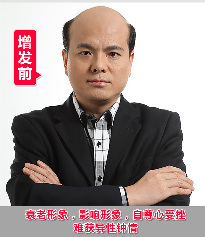 脫發(fā)男士如何擁有理想發(fā)型？真人發(fā)假發(fā)訂做幫你實(shí)現(xiàn)夢(mèng)想