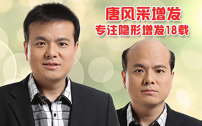 包頭那里有男人假發(fā)買？什么假發(fā)質(zhì)量好