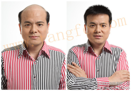 唐風采補發(fā)合肥店怎么樣？隱形無痕的效果是真實的嗎？