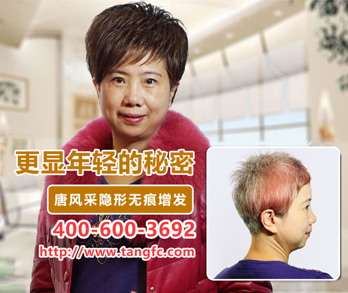 崇尚健康的烏魯木齊假發(fā)店，用物理方式遮蓋白發(fā)！