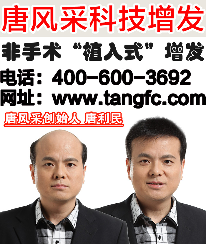 真人發(fā)中年男士假發(fā)多少錢？中年人為何易禿
