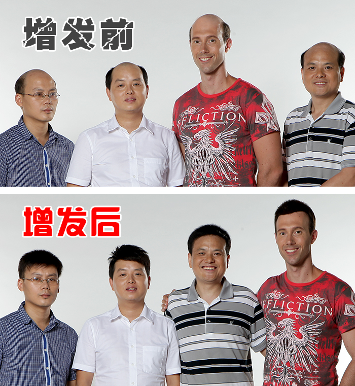 頭發(fā)是有零件可配的！常德賣假發(fā)的地方在哪里？