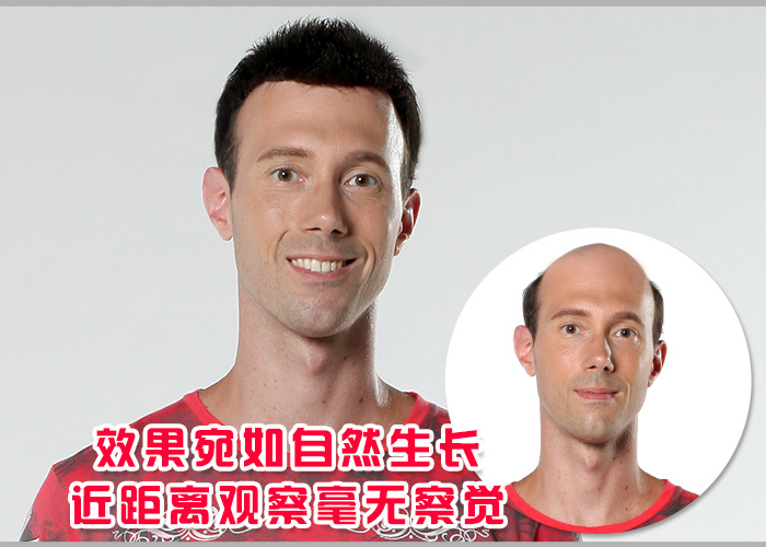 拉薩織發(fā)補(bǔ)發(fā)需要多少錢？唐風(fēng)采價(jià)格統(tǒng)一119元/單位！
