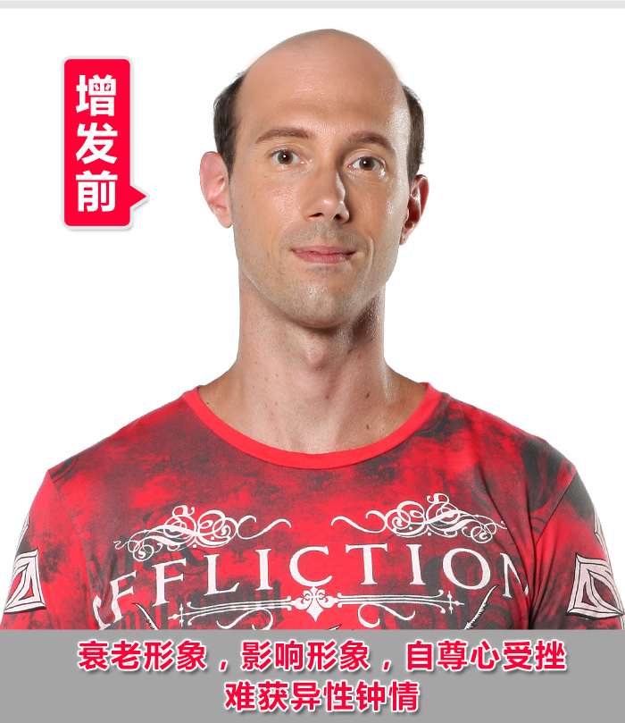 定制屬于自己的男士假發(fā)，讓你從此遠離尷尬
