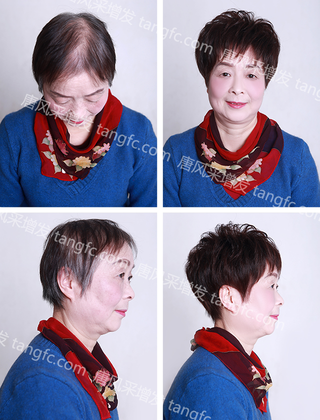 拉薩買隱形假發(fā)哪家好？唐風(fēng)采增發(fā)技術(shù)好！