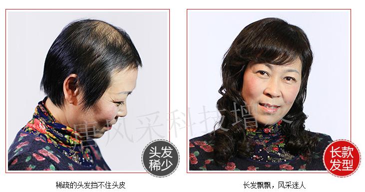 嘉興織發(fā)補發(fā)中心，唐風(fēng)采專業(yè)補發(fā)塑造完美形象