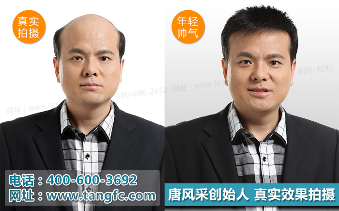 奧尼爾戴白發(fā)開懟，小伙伴們千萬別模仿！