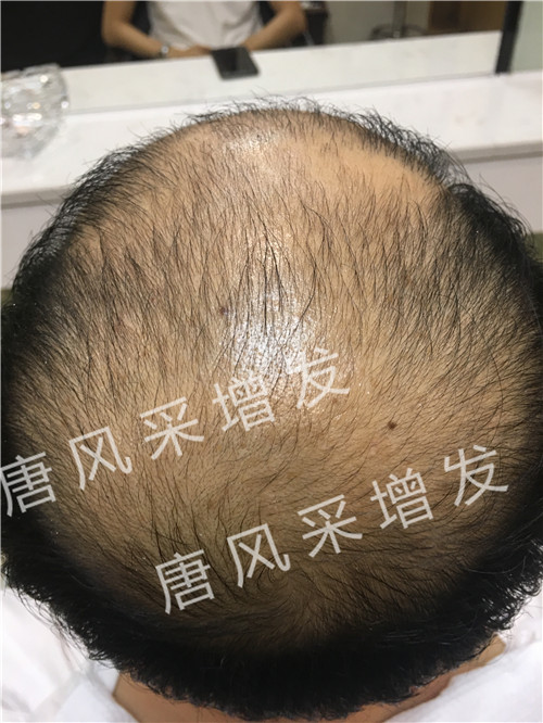 今天咱不看廣告宣傳了，唐風(fēng)采真實效果，上圖上視頻