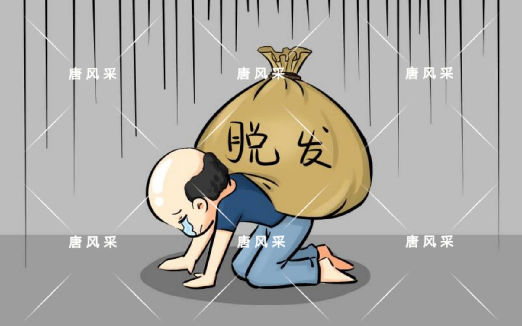 男人脫發(fā)原因多，不能一味怨腎虧！
