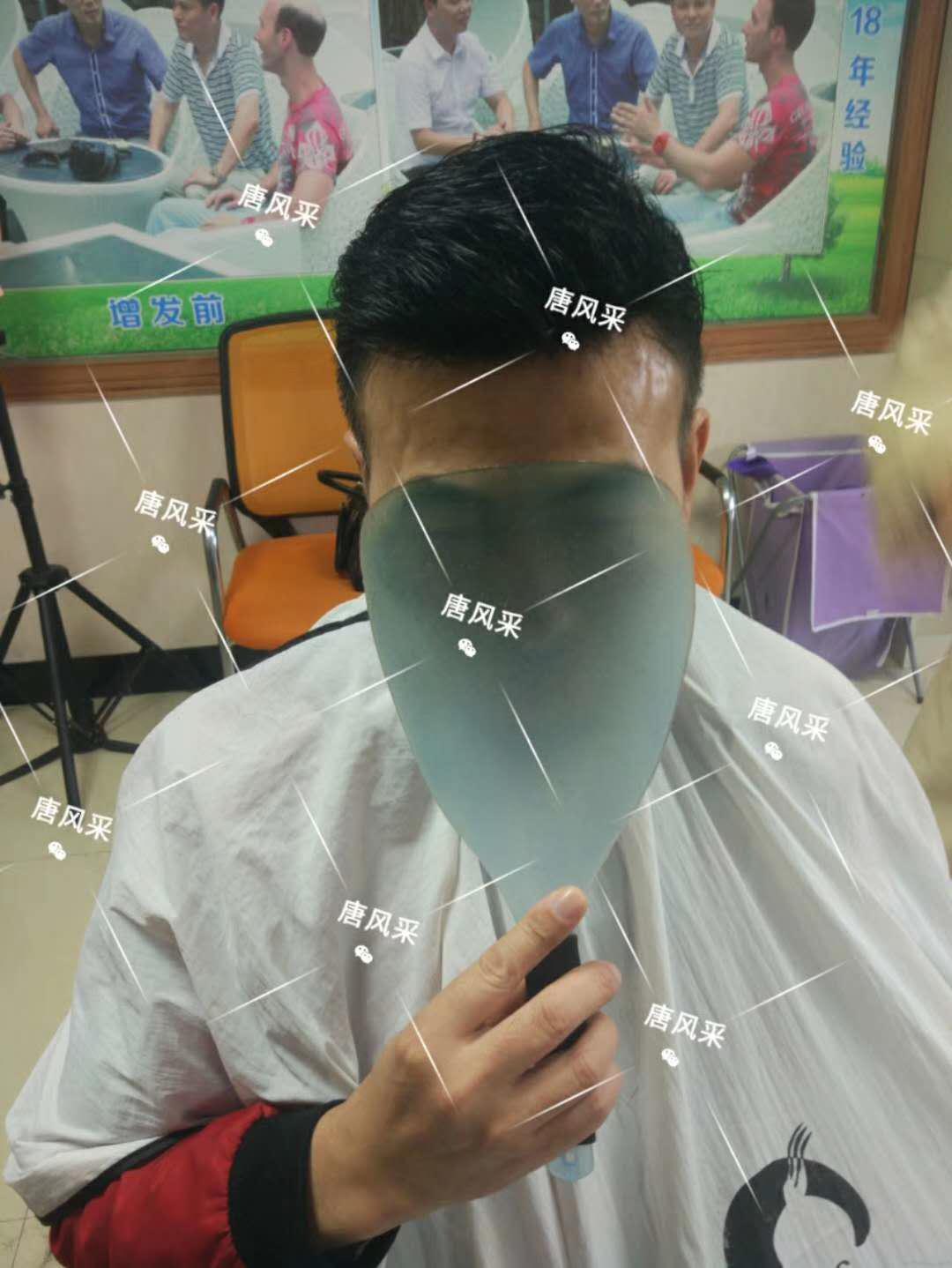男人脫發(fā)原因多，不能一味怨腎虧！