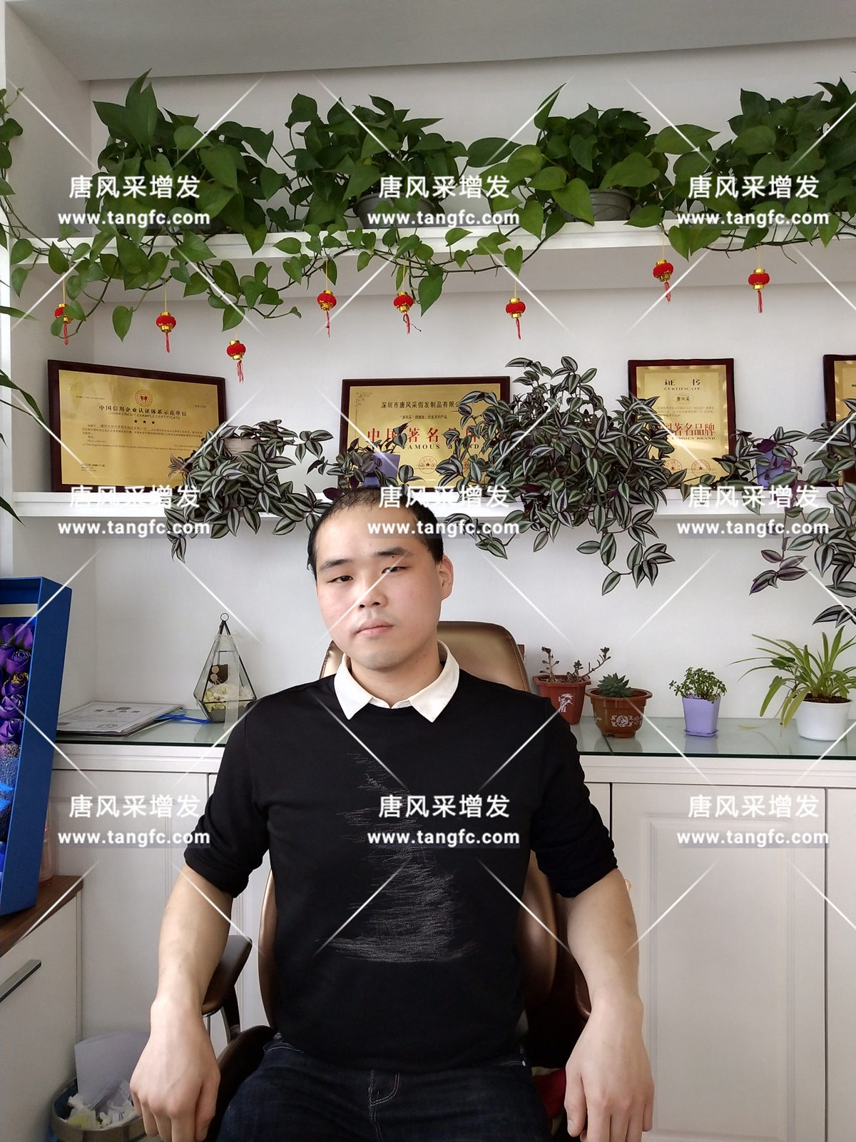 增發(fā)還是植發(fā)，這是個問題！