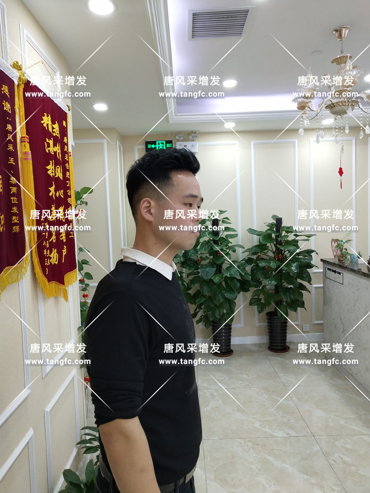 增發(fā)還是植發(fā)，這是個問題！