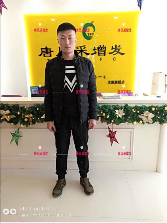 好形象擁抱新生活，唐風采助力脫發(fā)新青年！