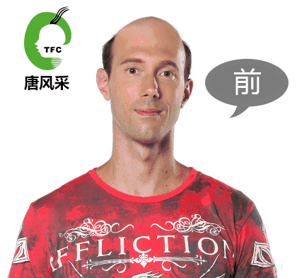 臺州男士補發(fā)哪里好？向你推薦唐風(fēng)采增發(fā)！