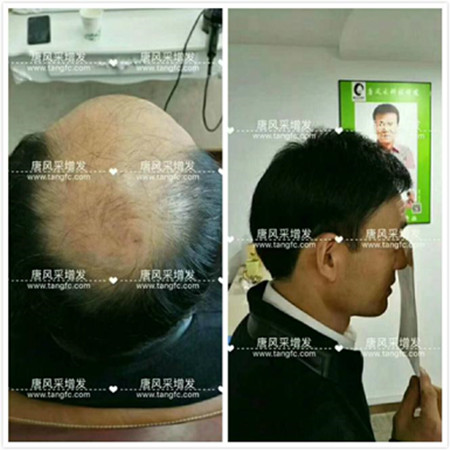 男款假發(fā)品牌哪家好，有用過唐風(fēng)采的嗎？