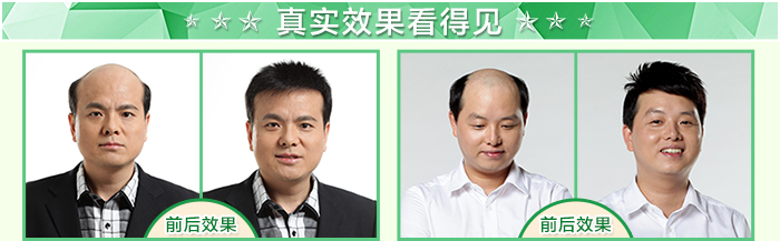 西寧哪里有假發(fā)專賣店 唐風(fēng)采增發(fā)案例
