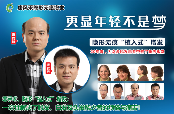 男士頭發(fā)稀少發(fā)型 唐風采增發(fā)