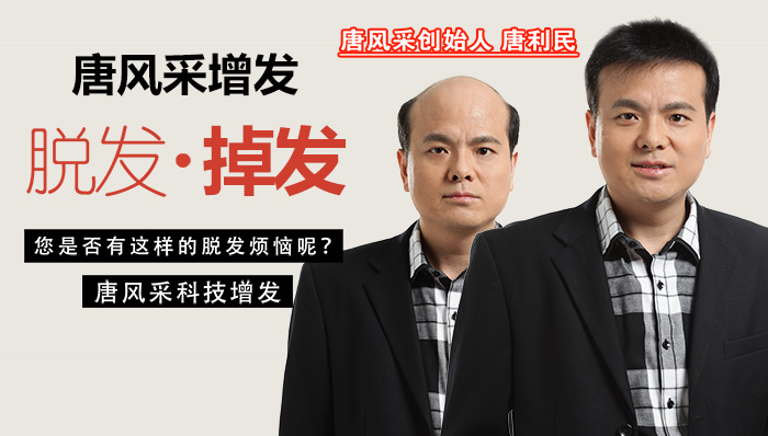 西寧哪有買假發(fā)的 唐風(fēng)采增發(fā)
