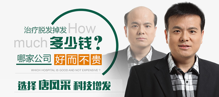 西寧哪有買假發(fā)的 唐風(fēng)采織發(fā)補(bǔ)發(fā)
