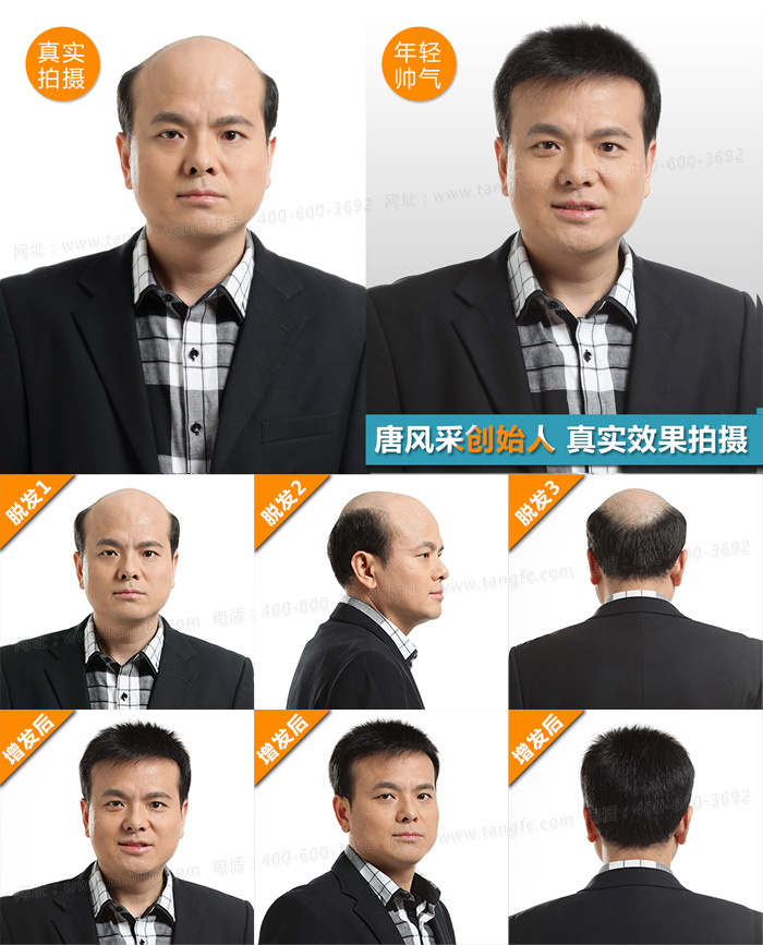 西寧哪有買假發(fā)的 唐風(fēng)采織發(fā)