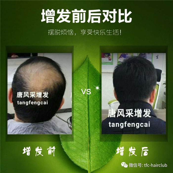 包頭哪里有真發(fā)假發(fā)套的專賣店？