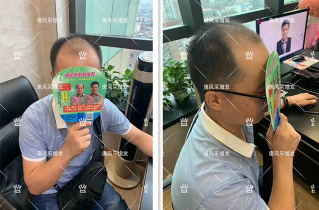 無痕真發(fā)發(fā)片 官方二維碼 唐風(fēng)采客戶案例