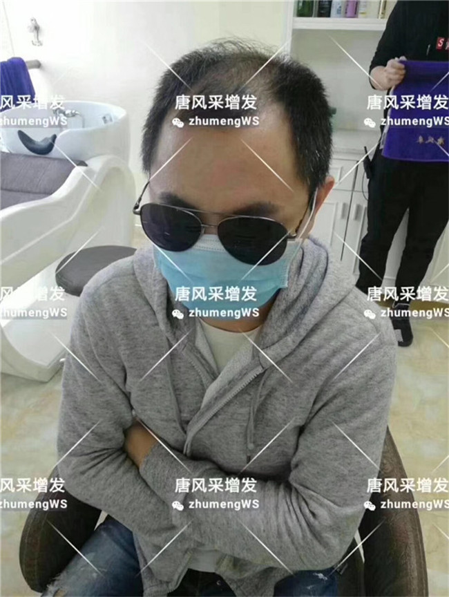 局部假發(fā)片 官方二維碼 唐風(fēng)采客戶(hù)案例