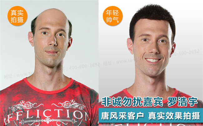 禿頂發(fā)型設(shè)計(jì) 唐風(fēng)采客戶