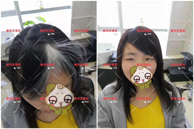遮蓋白發(fā)的假發(fā)片 唐風(fēng)采客戶(hù)案例