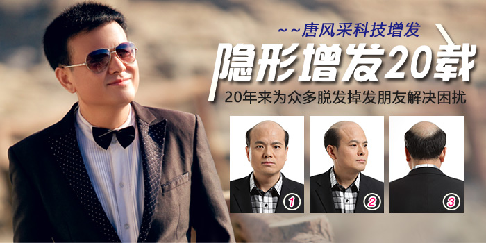 頭頂粘貼假發(fā)片 唐風(fēng)采黏貼式假發(fā)片深受發(fā)友喜愛(ài)