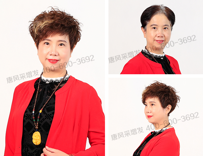 唐風(fēng)采成都店 唐風(fēng)采隱形增發(fā)效果真實(shí)自然