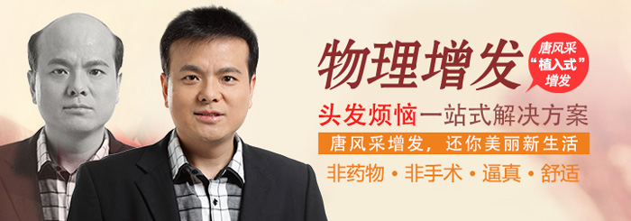 成都買(mǎi)假發(fā) 買(mǎi)假發(fā)需要注意哪些