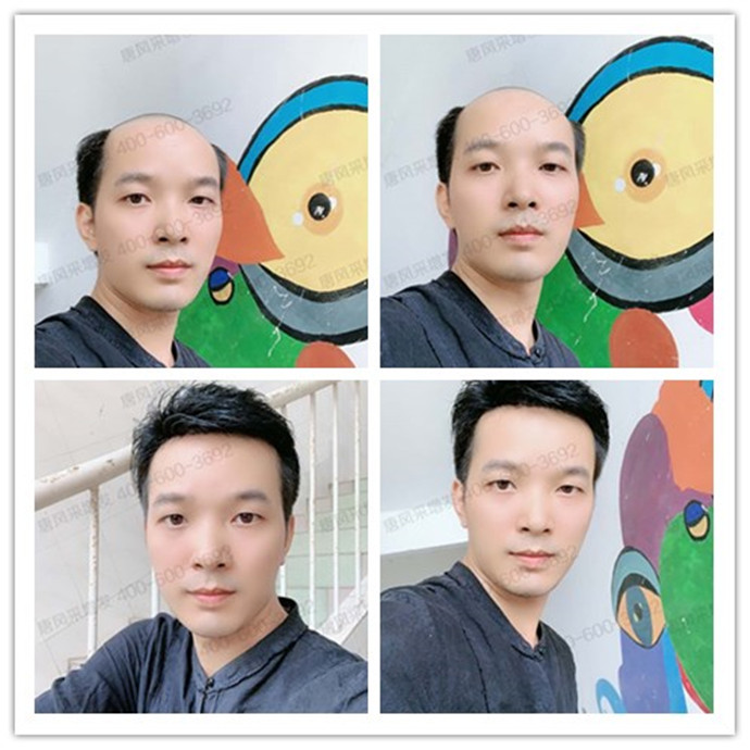 超級隱形發(fā)套 隱形自然