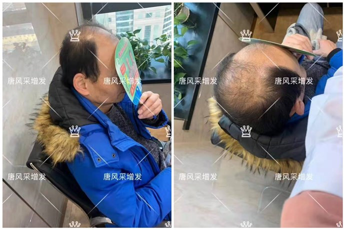 假發(fā)什么牌子質(zhì)量好 \